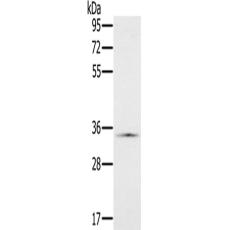 兔抗NDUFA9多克隆抗體